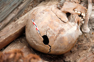 Hole in the crown of the human skull, Tomb No. 9